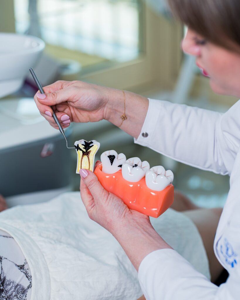 Лечение зубных каналов стоматологом